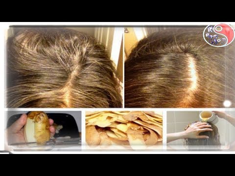 최신 새:머리카락에 감자의 영향.|KpKr