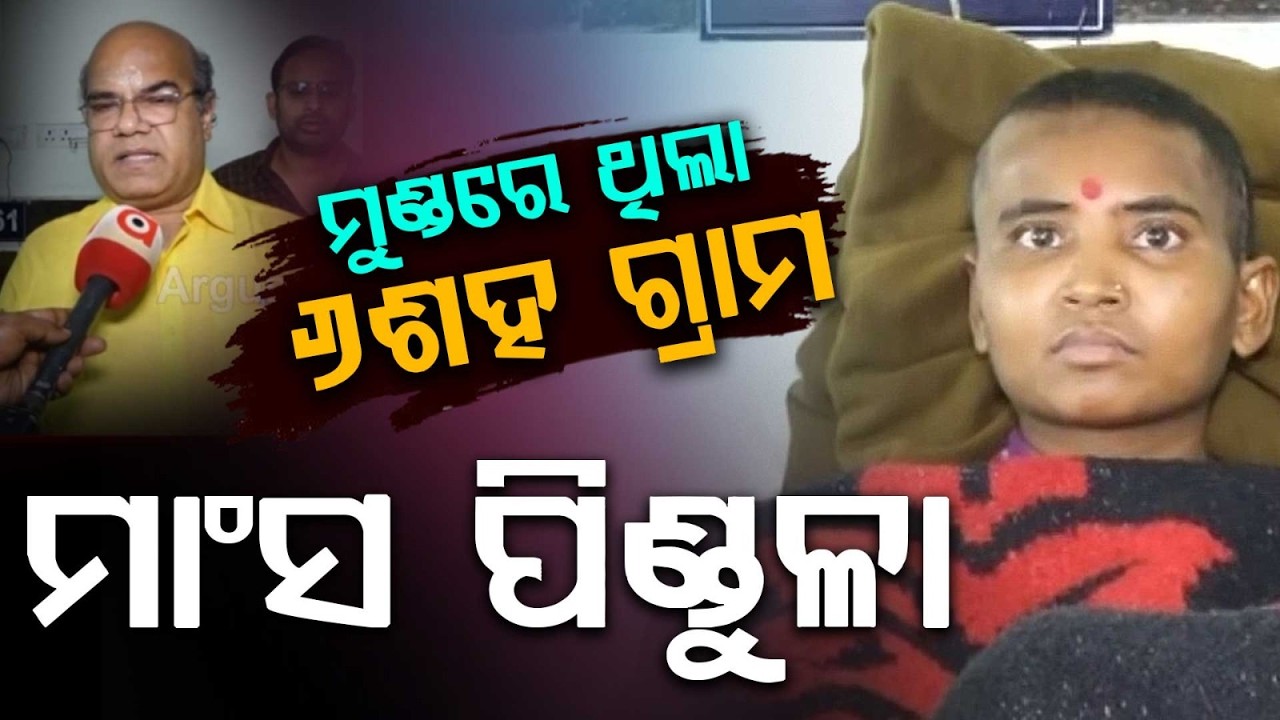 Successful Brain Surgery at MKCG: 600g Tumor Removed From Koraput Woman's Head | Argus News