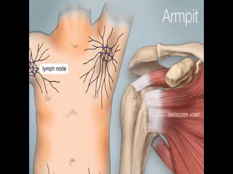 armpit pain in women - YouTube