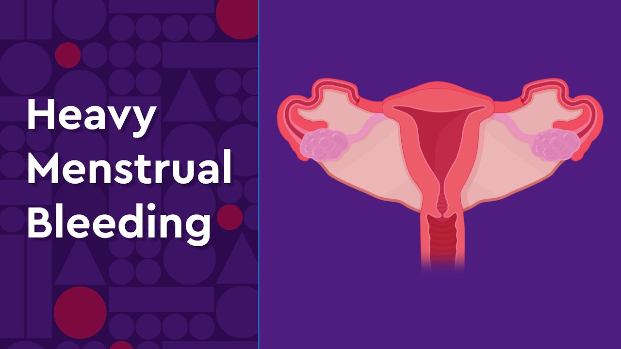 Women with Bleeding Disorders: 7 Ways to Manage Heavy Periods