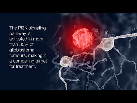 New positive data from phase IIa trial in brain cancer patients