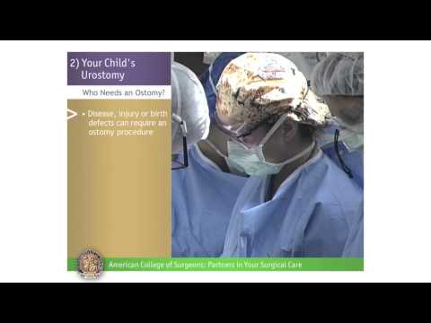 Pediatric Urostomy: Your Child's Urostomy