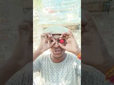 MY EYEBALL CAMEOUT#shorts🤯🧐👁️😅