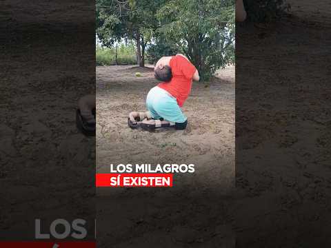 La historia del hombre que nació con la cabeza al revés