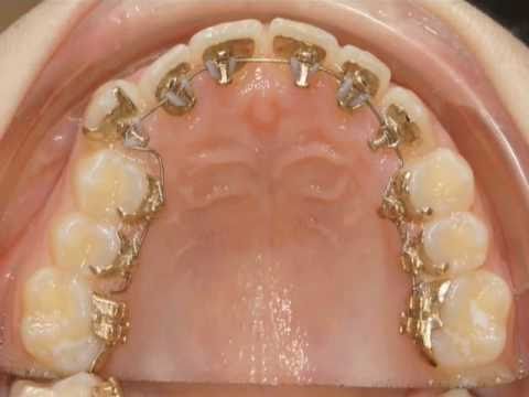 When Your Baby Is Born With Teeth: Natal Teeth | Oral Answers