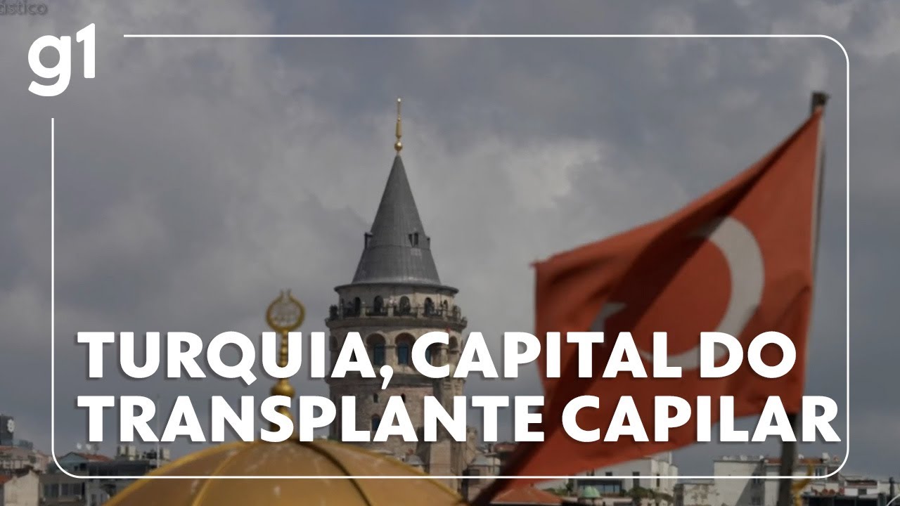 Turquia vira capital mundial do transplante capilar e atrai pacientes de todo o mundo