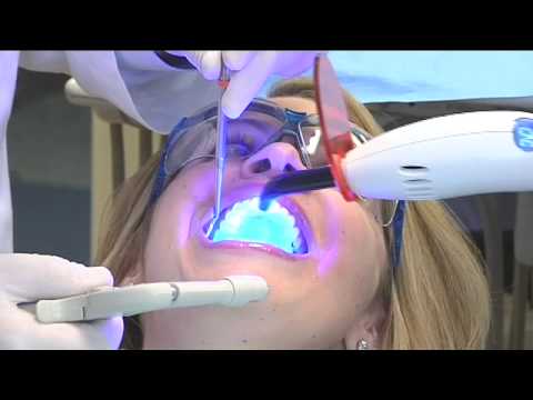 Cosmetic Dentists with Smile Makeovers  La Jolla, California - YouTube