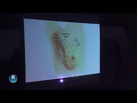مجلس المرأة السورية ينظم جلسة توعوية حول سرطان الثدي في حلب ضمن حملة "أكتوبر الوردي"