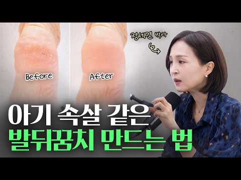 촉촉함 10배 증가! 발뒤꿈치, 건조한 피부 관리 꿀팁 | 정세연의 라이프연구소