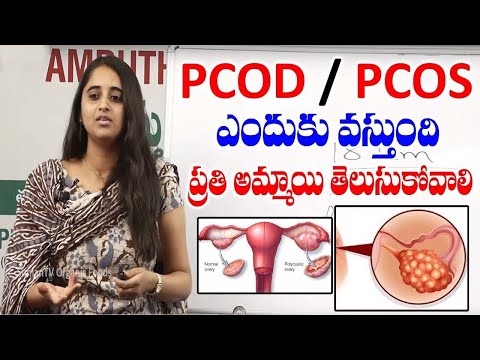 PCOD/PCOS Causes, Symptoms and Remedies || Dr Sarala Khadar || SumanTV HealthCare