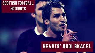 Scottish Football Hotshots – Rudi Skacel