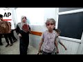 Gaza City hospitals are under immense pressure