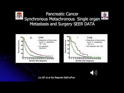 US09: Resection of Metastatic Pancreas Adenocarcinoma