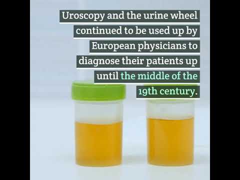 What Could Your Urine Tell A Medieval Doctor?