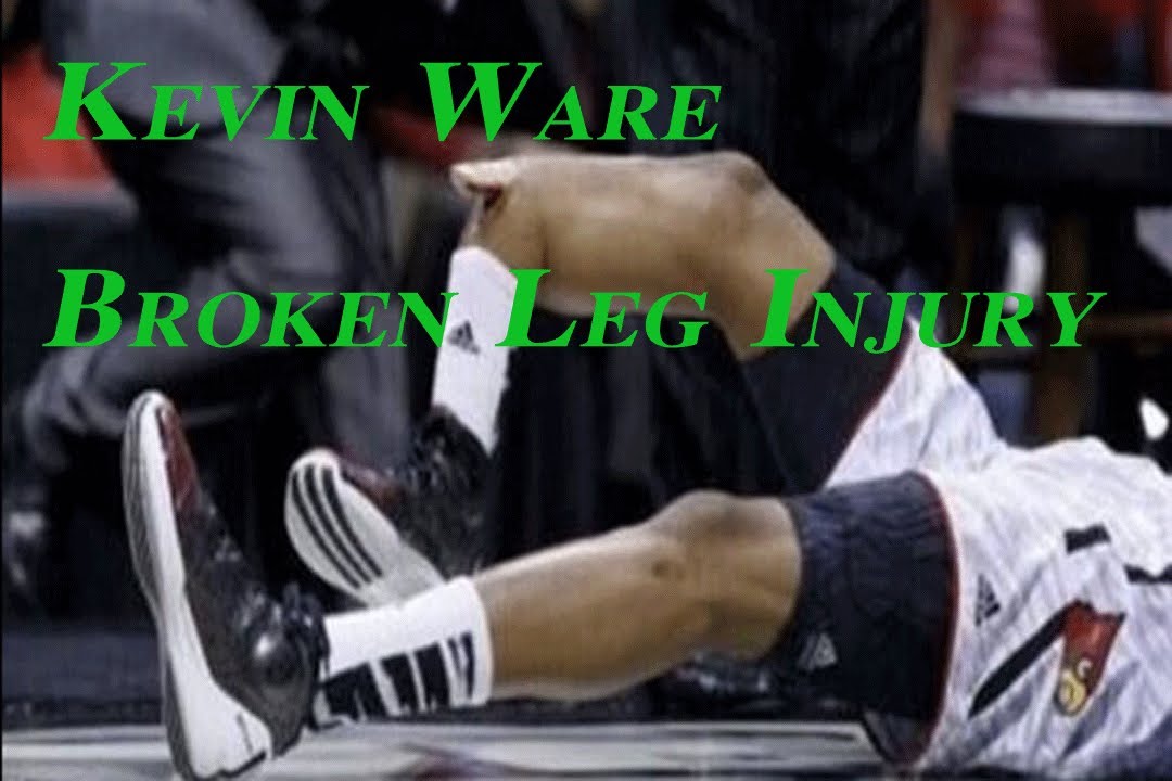 Road To NBA 2K13 - NBA 2K13 MyCareer - Kevin Ware Broken Leg vs Duke! - YouTube