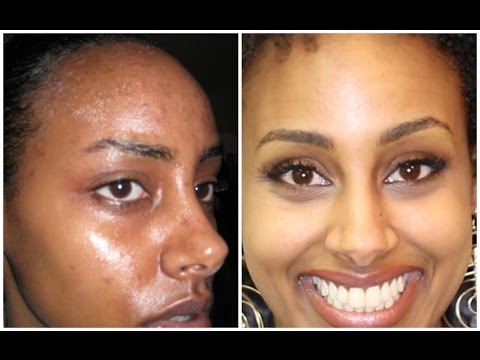 Best Acne Treatment How Get Flawless Skin Skin Care 