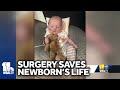 3-month-old undergoes lifesaving surgery