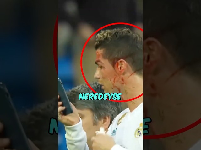 Ronaldo Sakatlığı Yüzünden Neredeyse Ölüyordu👀😭