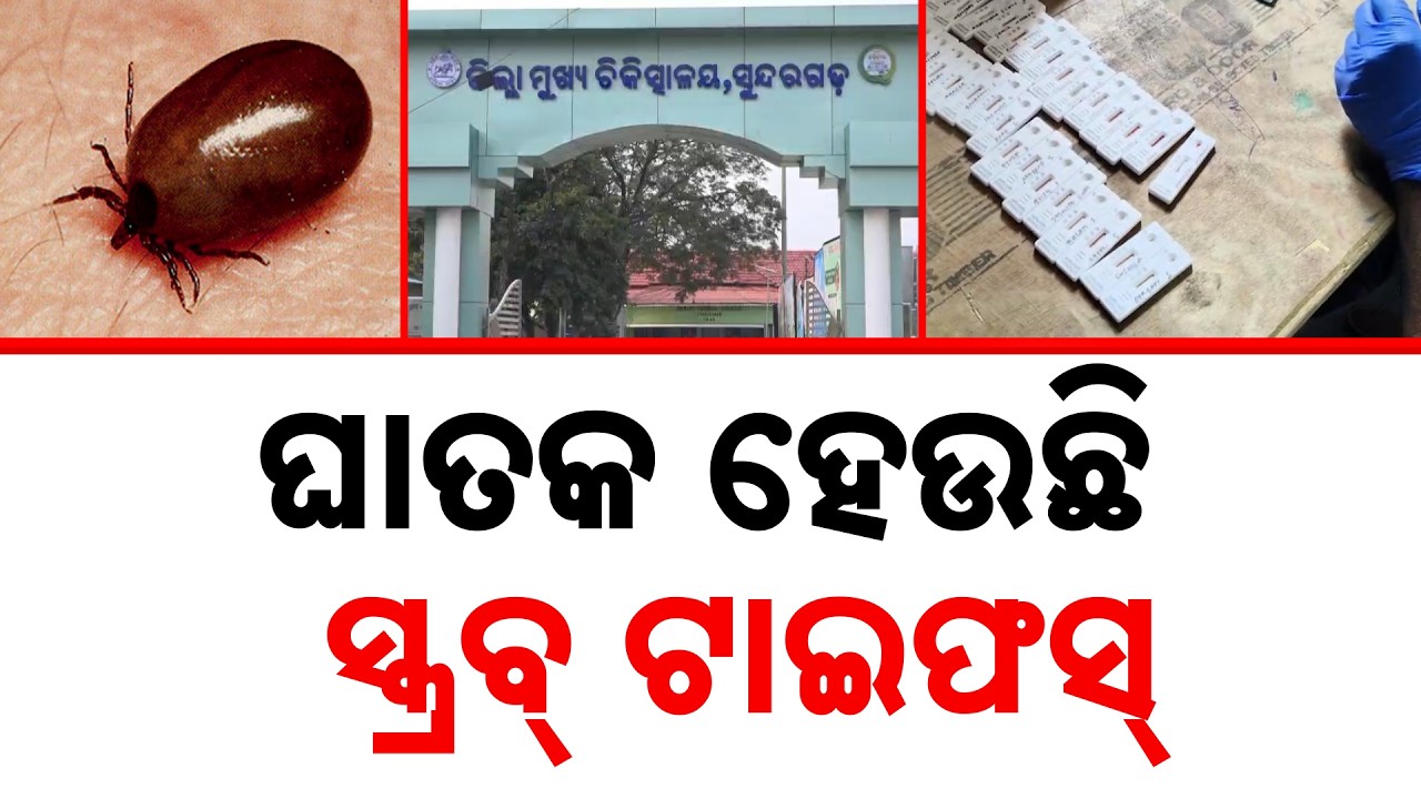 Scrub Typhus Cases Surge Past 900 In Sundargarh; 24-Hour Control Room Opened | Argus News