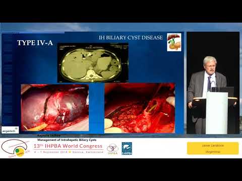 KN01 Management of Intrahepatic Biliary Cysts