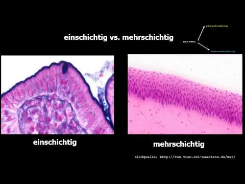 Epithelgewebediagramm beschriftet