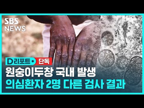 [단독] 국내 원숭이두창 의심 환자 2명…1명 1차 양성, 1명 음성 / SBS / #D리포트