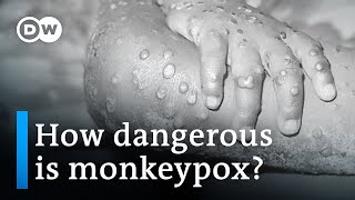 Concern grows as more countries detect monkeypox | DW News