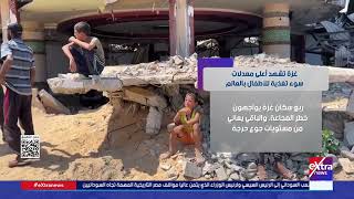 غزة تشهد أعلى معدلات سوء تغذية للأطفال بالعالم