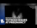 Thyroid issues during pregnancy can lead to complications