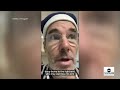 Surgeon in Gaza talks about difficult injuries, lack of resources  - 08:15 min - News - Video