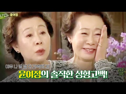 윤여정 성형고백