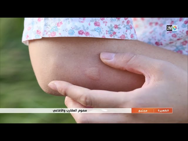 سموم العقارب و الأفاعي ..