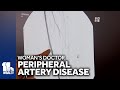 Womans Doctor: Diagnosing peripheral artery disease or PAD in women