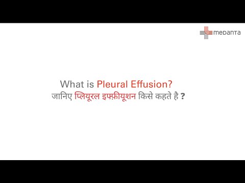 What is Pleural Effusion? | फुफ्फुस बहाव के लक्षण | फुफ्फुस बहाव के प्रकार | Dr. Tejveer Singh