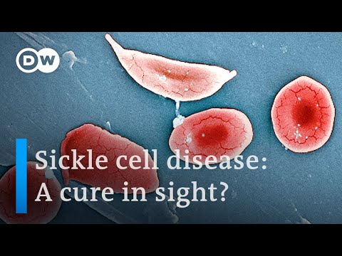 Sickle cell disease: What it is and how to fight it | DW News