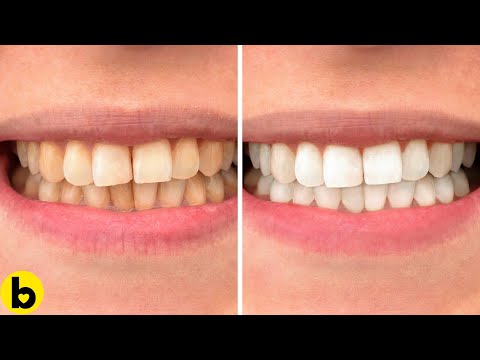 Пет едноставни трикови за природно избелување на забите