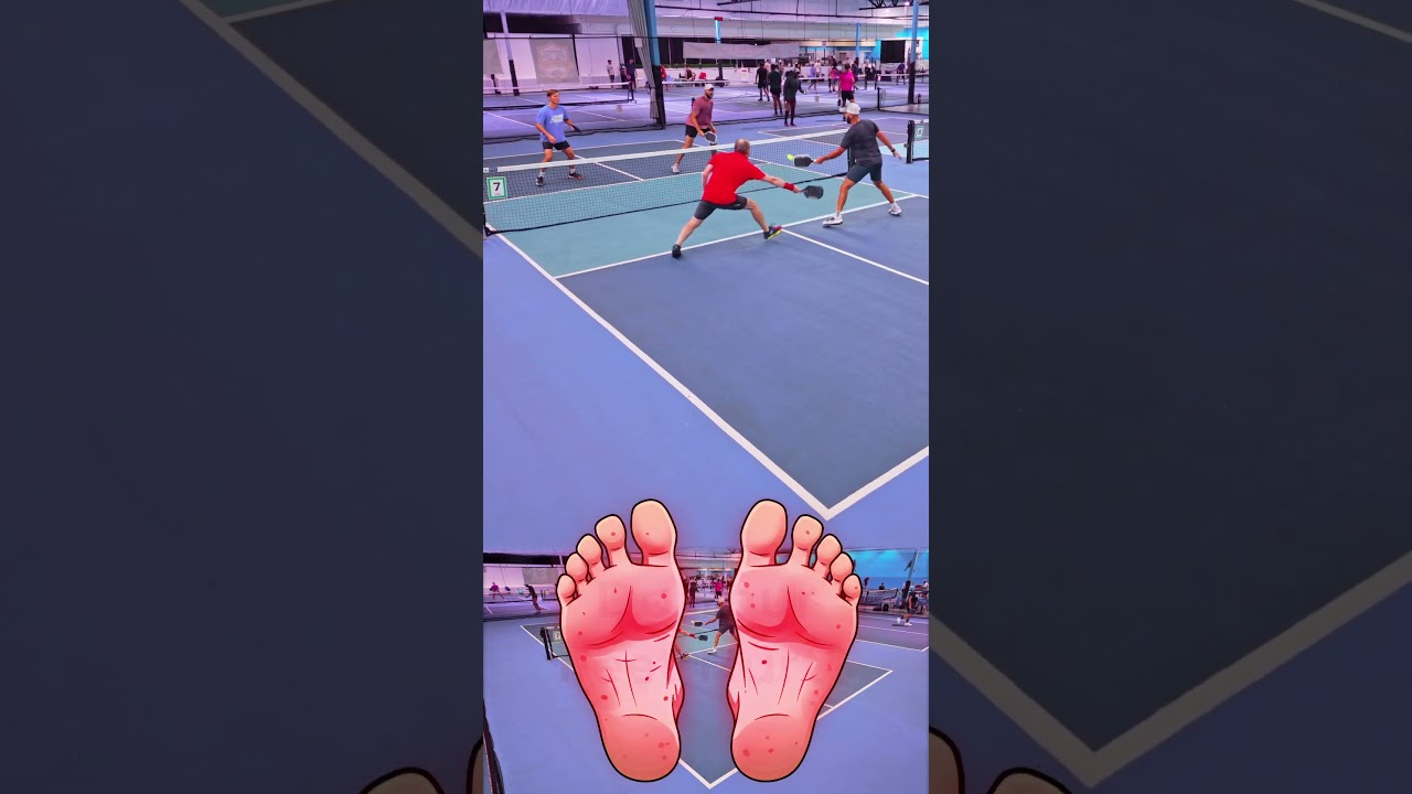 🤦Triple Erne Attempt Fail #pickleballhighlights #pickleball #sports #sporthighlights
