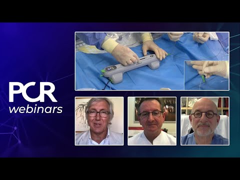 When and how should I treat a calcific coronary stenosis with orbital atherectomy? – Webinar