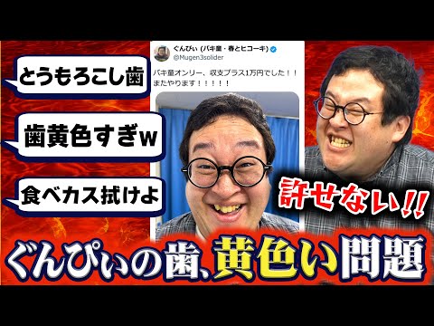 【不潔】ぐんぴぃの歯が黄色すぎてSNSで何も伝わらなかった件【歯医者】
