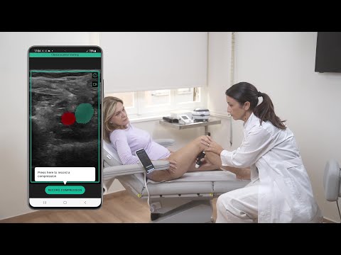 Clarius Marketplace unlocks the power of ultrasound imaging AI innovation