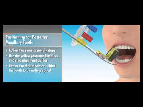 Posicionadores Dentsply Rinn - www.digitaldent.com.ar (480p).flv - YouTube