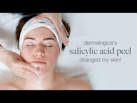 Dermalogica' s Salicylic Acid peel changed my skin!