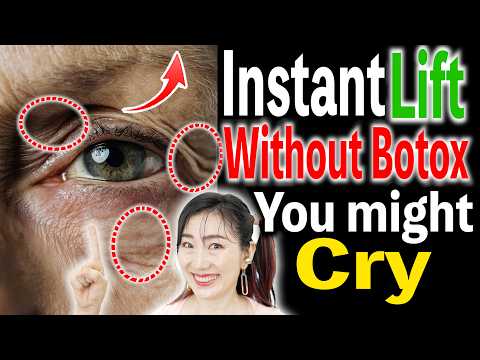 Instant Eye Lift for Hooded Eyes without Botox! So Powerful It Brings Tears