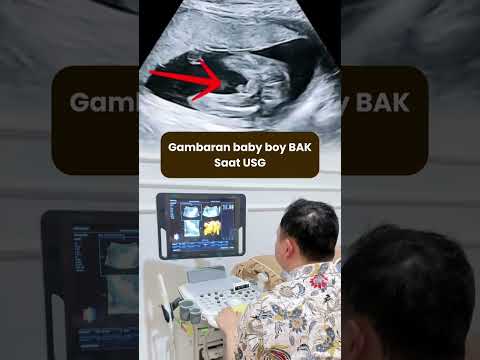 Gambaran Baby Boy Saat Usg