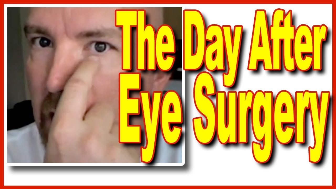 Surviving Eye Surgery The Day After Chalazion Part 2 Youtube