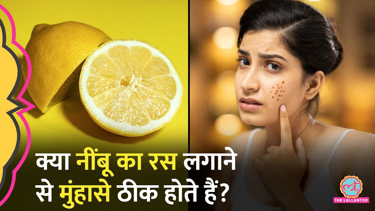 Acne या Pimples ठीक करने के लिए Lemon Juice लगाकर बड़ी गलती कर रहे हैं आप!