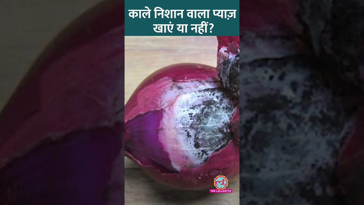 अगर Onion पर Black Mold लगा है तो उसे खाना चाहिए या नहीं? Expert से जानिए! #Sehat #ltsehat