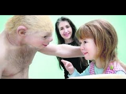 Patricia Piccinini * Relativity * Art Exhibition.* Galway * July 13-26, 2015