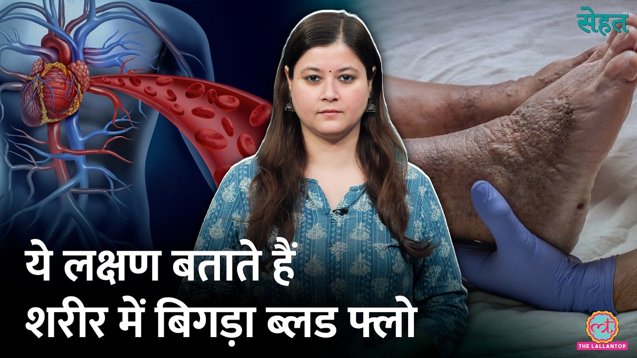 Poor Blood Circulation की वजह से बीमारियों ने घेरा? ये टिप्स आएंगी काम | Sehat 1322