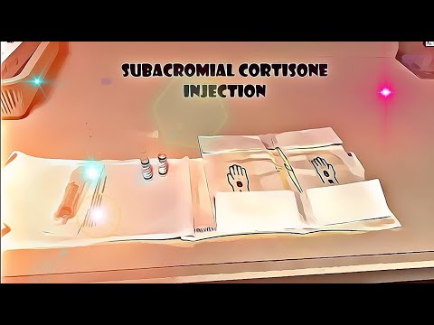 Subacromial Injection *Posterior Technique*